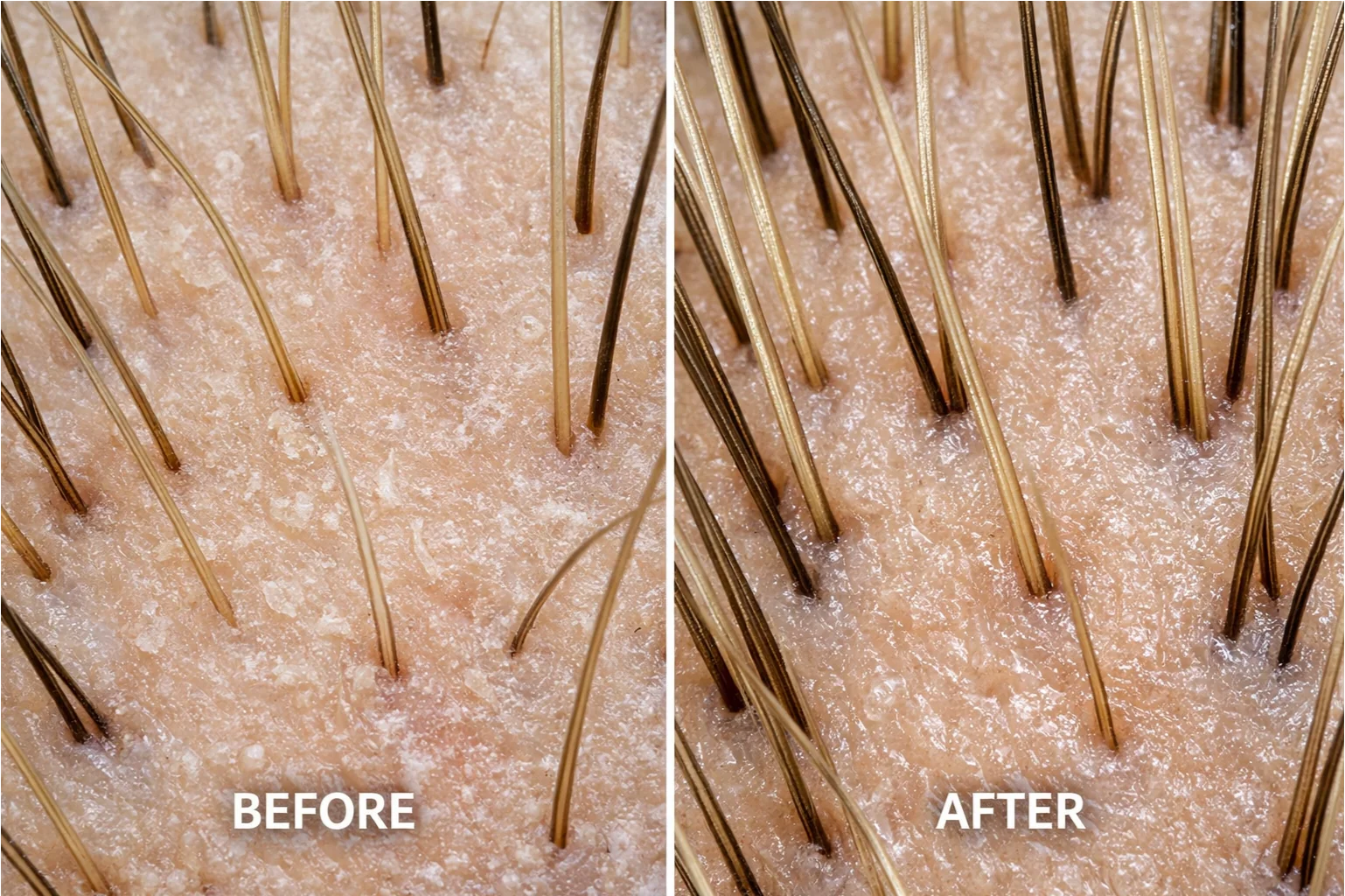 Repair & Hair Thickening For All Hair Types - 10 Minute Miracle - Ultimate Set - Image 3