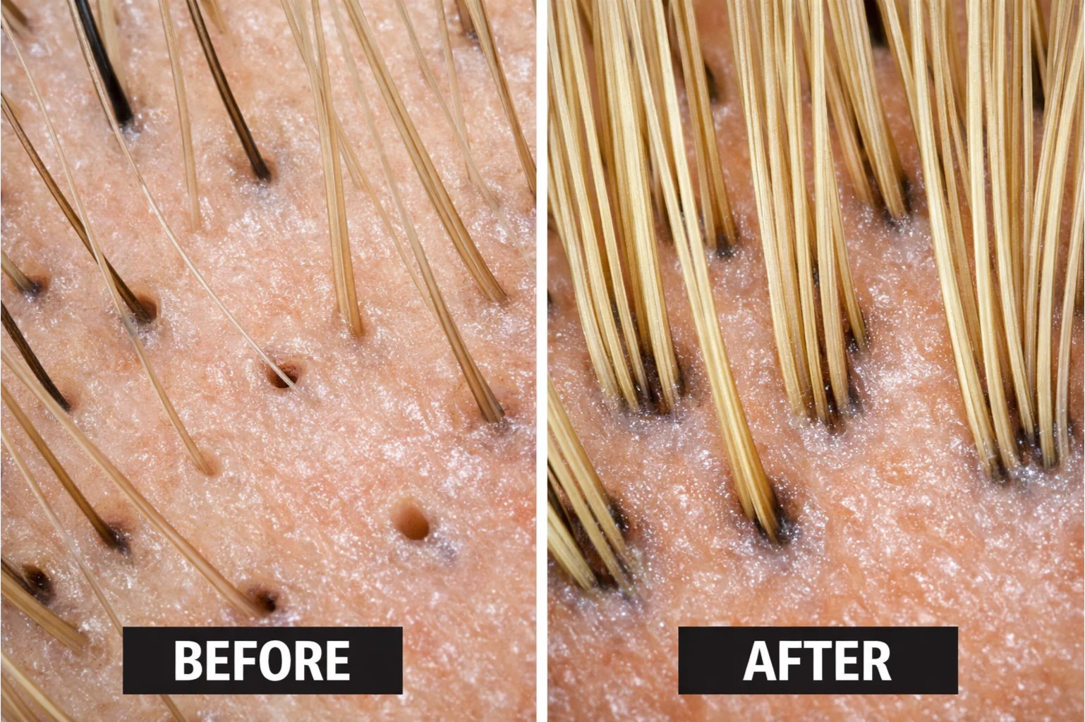 Stop Hair Loss & Real Hair Regrowth for All Hair Types - 10 Minute Miracle - Conditioner 500ML - Image 4