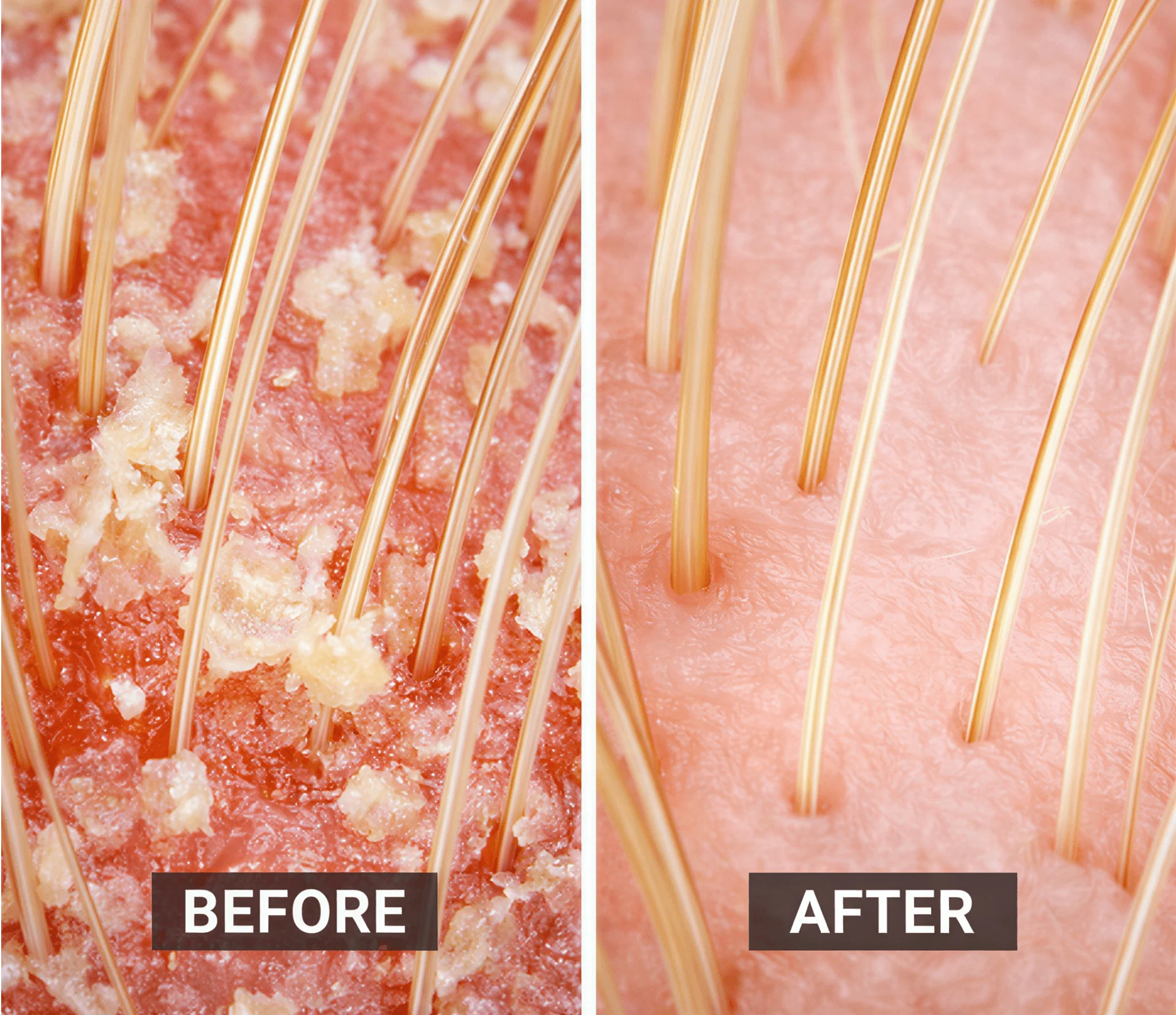Scalp & Body Care For Your: Psoriasis, Eczema, Itching, Sores, Scabs & Dandruff - Relief in 10 Minutes - Ultimate Set - Image 5