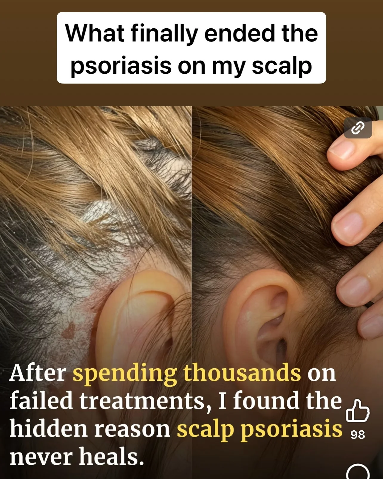 Scalp & Body Care For Your: Psoriasis, Eczema, Itching, Sores, Scabs & Dandruff - Relief in 10 Minutes - Ultimate Set - Image 3